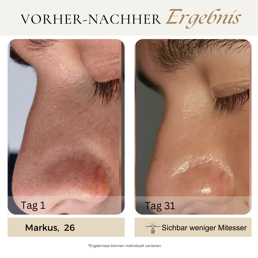 CHES | Reis Peeling Ritual Set