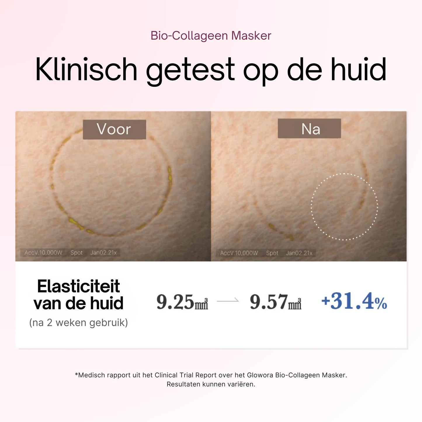 CHES | COLLAGEEN MASKER