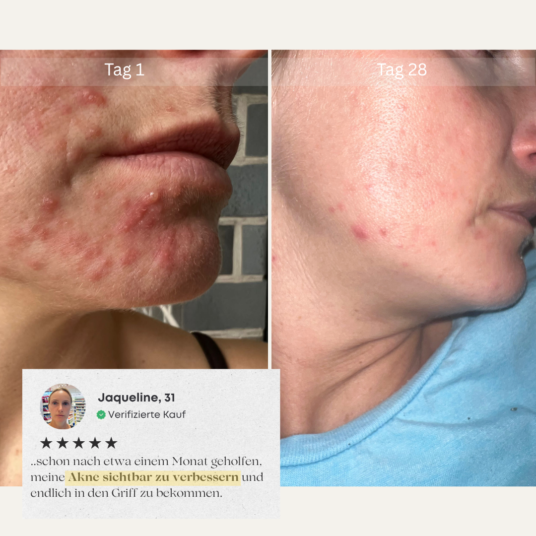 CHES | Reis Peeling Ritual Set