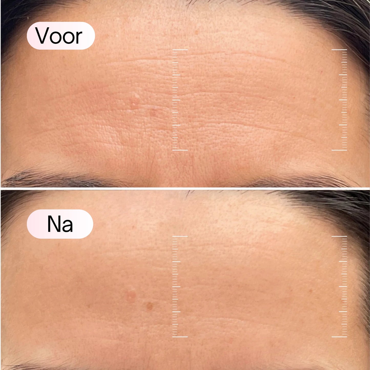 CHES | COLLAGEEN MASKER