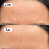 COLLAGEEN MASKER