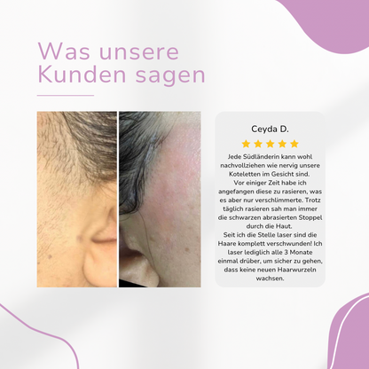 CHES | IPL Hair Remover