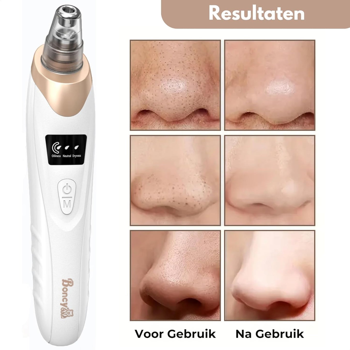 CHES | Premium Blackhead Remover