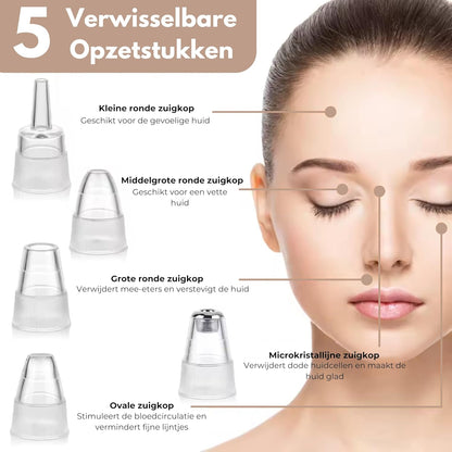 CHES | Premium Blackhead Remover