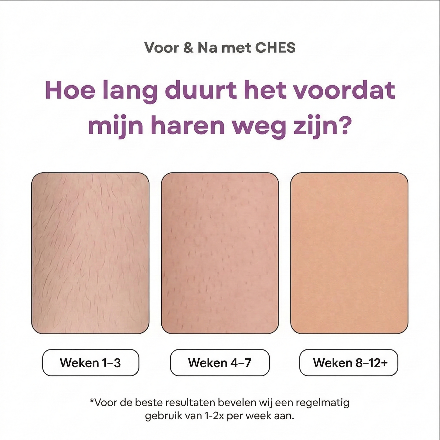 CHES | IPL Hair Remover