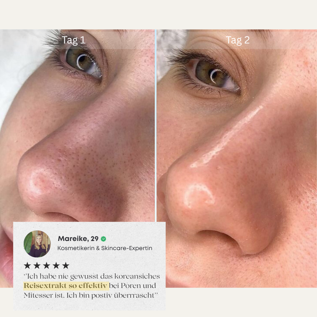 CHES | Reis Peeling Ritual Set